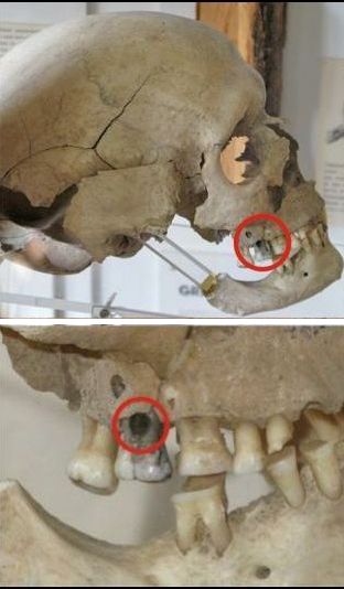 Dental Technology in the Stone Age