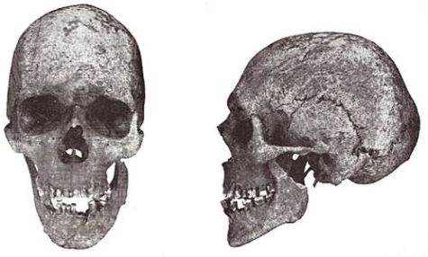 Dolichocephalic male skull from Hjadstrup on Fyn