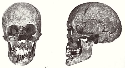 Dolichocephalic female skull from Almager on Sjælland