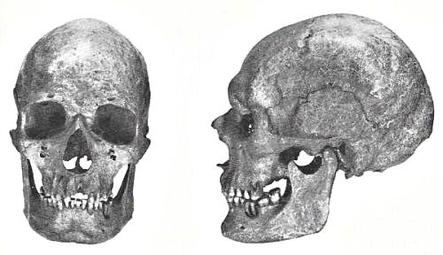 Dolichocephalic man skull from Vester Egesborg on Stevns on Sjælland