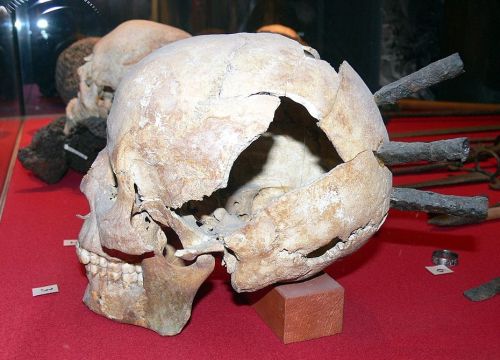 Skull of one of the fallen at Visby